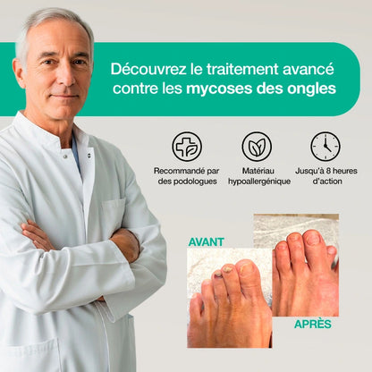 Dermisya® – Patch antifongique pour mycose de l’ongle