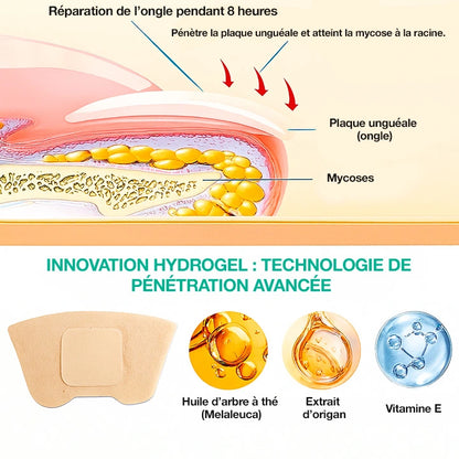 Dermisya® – Patch antifongique pour mycose de l’ongle