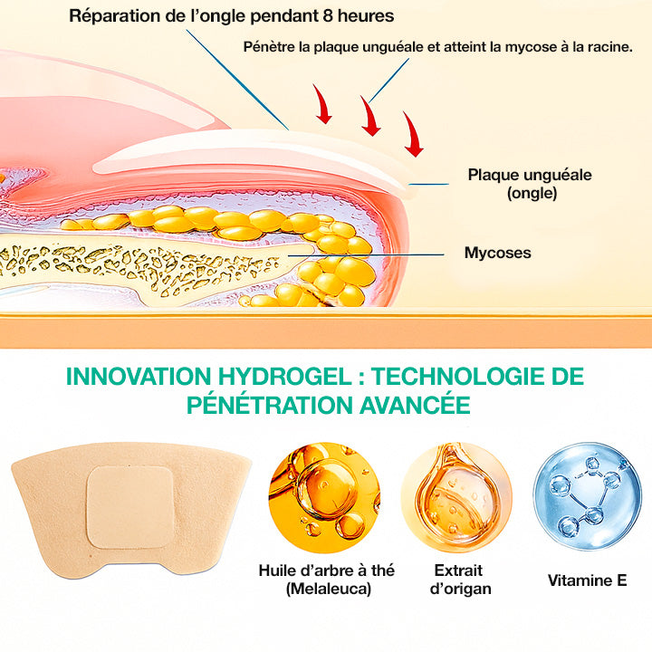 Dermisya® – Le traitement avancé contre les mycoses des ongles