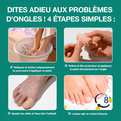 Dermisya® – Le traitement avancé contre les mycoses des ongles