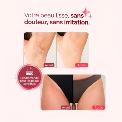 DermaFlex™ — Épilation douce, sans douleur ni rougeur