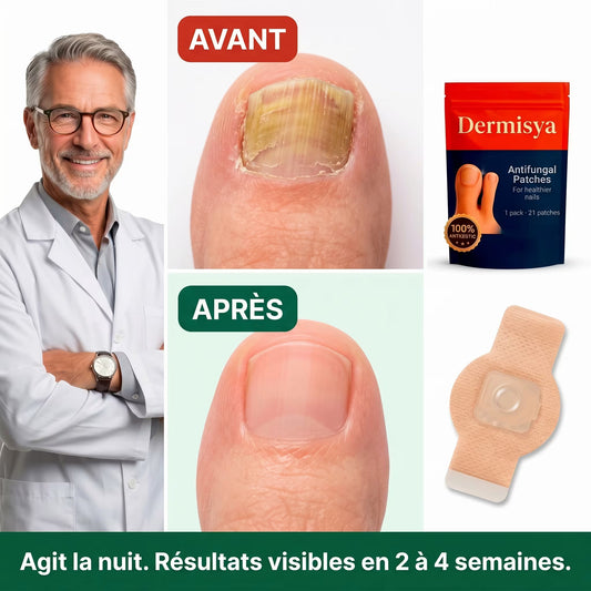Dermisya® — Patch Antifongique Nocturne