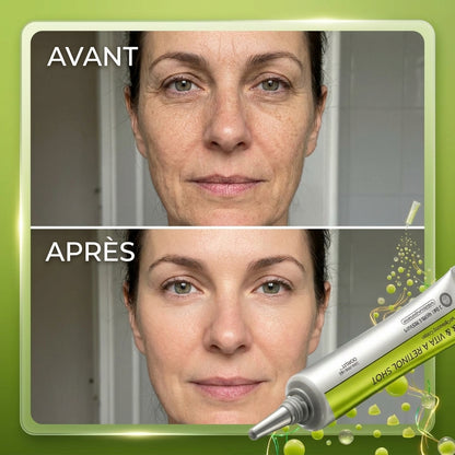 Dermisya® — Retinol Lift & Botox Shot