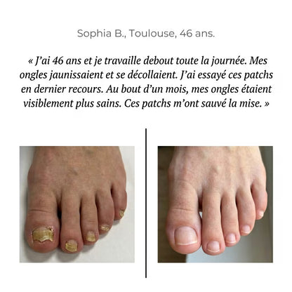 Dermisya® — Patch Antifongique Nocturne