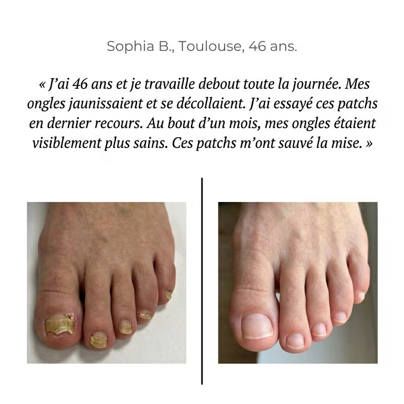 Dermisya® — Patch Antifongique Nocturne