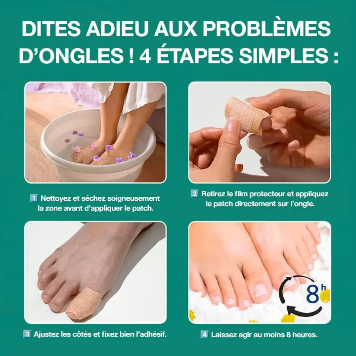 Les 4 étapes d’application du patch