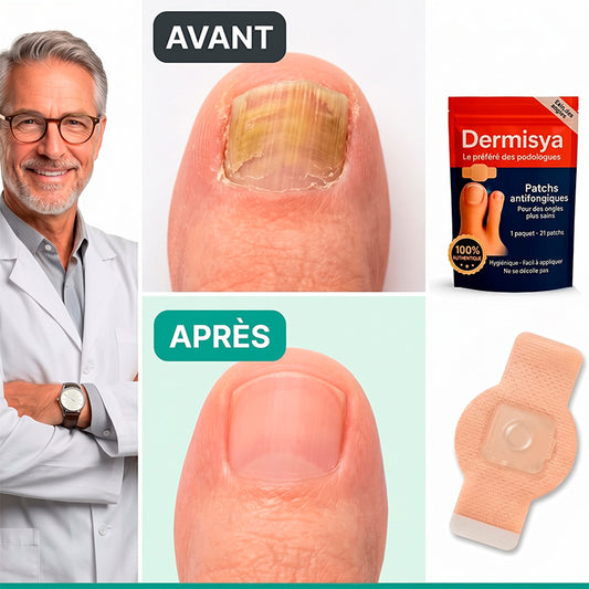 Dermisya® — Patch antifongique nocturne.